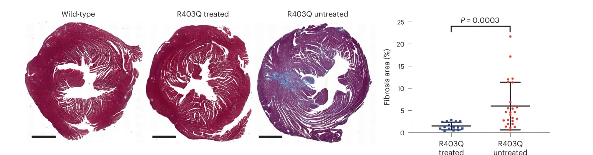 Open access visualization of Microscopy, Scatter Plot, Error Bars, Masson-trichrome staining, LV