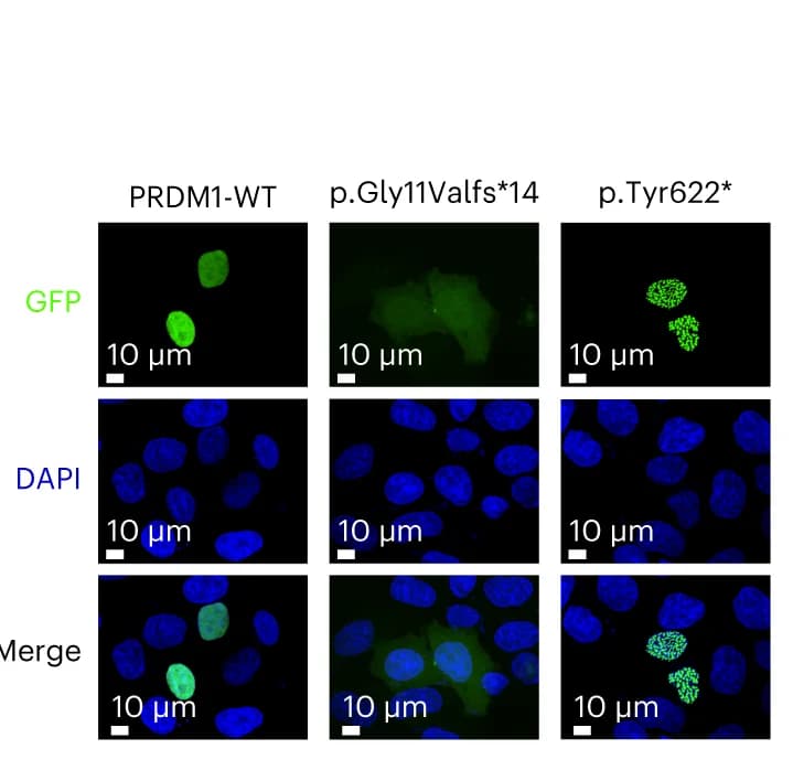 Open access visualization of Microscopy, Fluorescence microscopy, PRDM1 mutants, HeLa cells