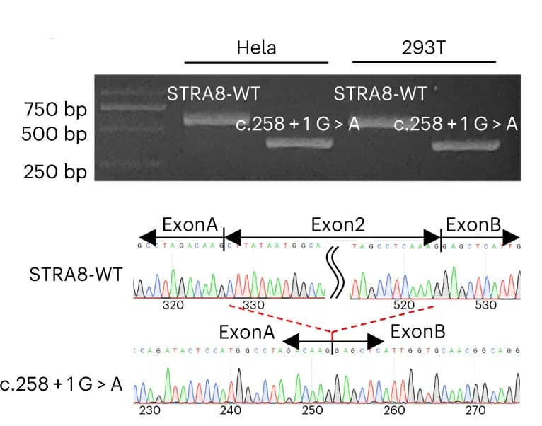 Open access visualization of Gel, Agarose gel electrophoresis, Sanger sequencing, STRA8, cDNA