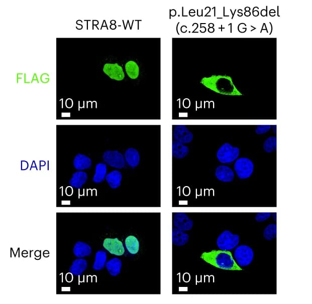 Open access visualization of Microscopy, Fluorescence images, STRA8 mutants, HeLa cells