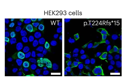 Open access visualization of Microscopy, Immunofluorescence microscopy, HEK293 cells, Wild-type ERG, p.T224Rfs*15 variant ERG
