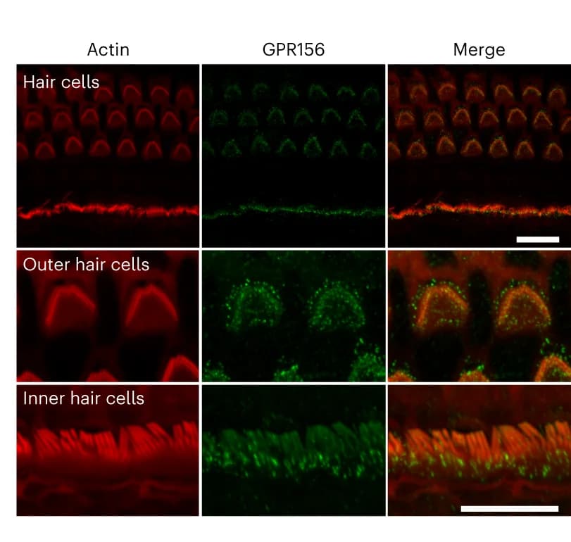 Open access visualization of Microscopy, Confocal Z stacks, Organ of Corti, Vestibular system, Wild-type mouse