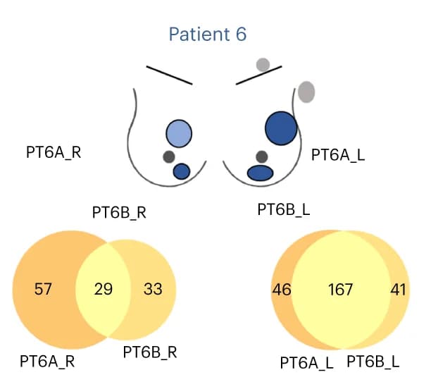 Open access visualization of Venn Diagram, Illustration, Tumor Mutation, Venn Diagrams, Primary Tumors