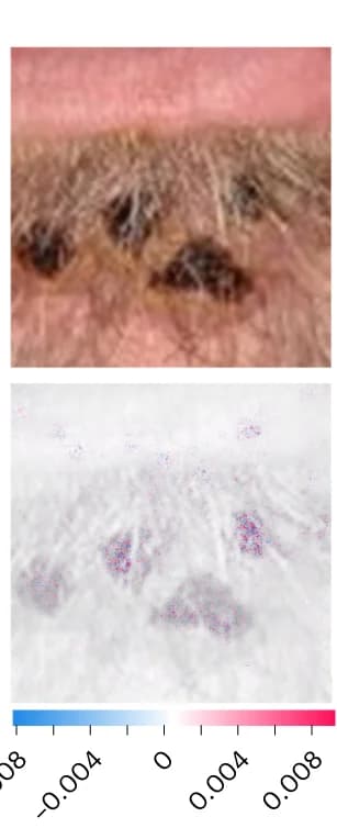 Open access visualization of Photo, Crusted Plaques, SHAP Analysis, MPXV Skin Lesion, MPXV-CNN