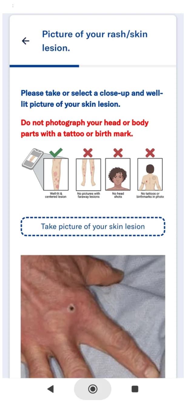 Open access visualization of Photo, Illustration, Skin Lesion, Photograph, Prompt