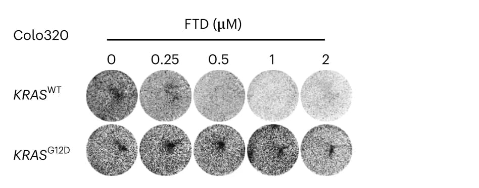 Open access visualization of Gel, Colony Formation Assay, KRAS WT, KRAS G12D, Colo320