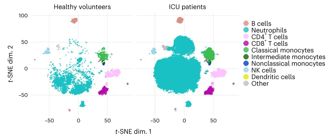 Open access visualization of Scatter Plot, UMAP, t-SNE, Dimensionality reduction, Immune landscape