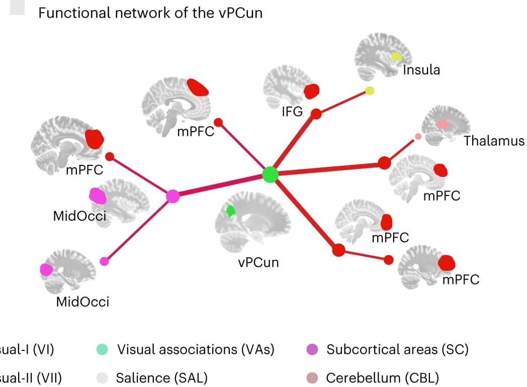 Open access visualization of Network, Pathway, Functional Connection Network, Ventral Precuneus