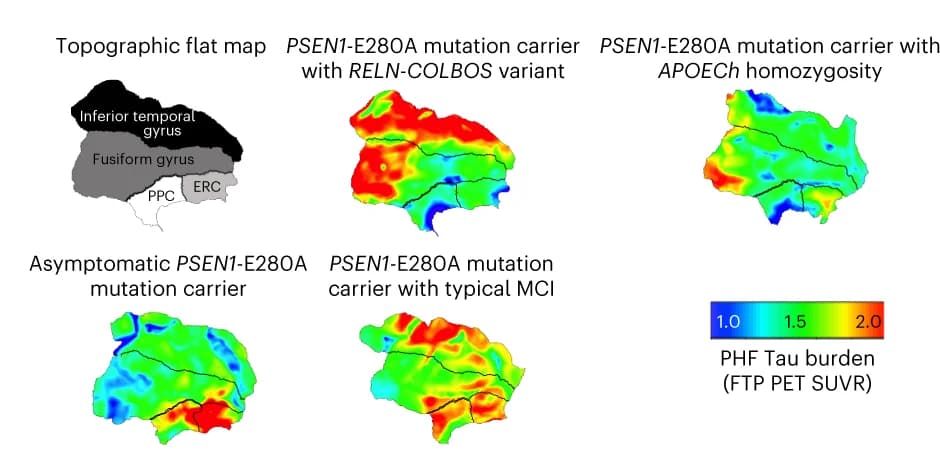 Open access visualization of Heatmap, Geo Map, Tau burden, Temporal cortex, ROIs