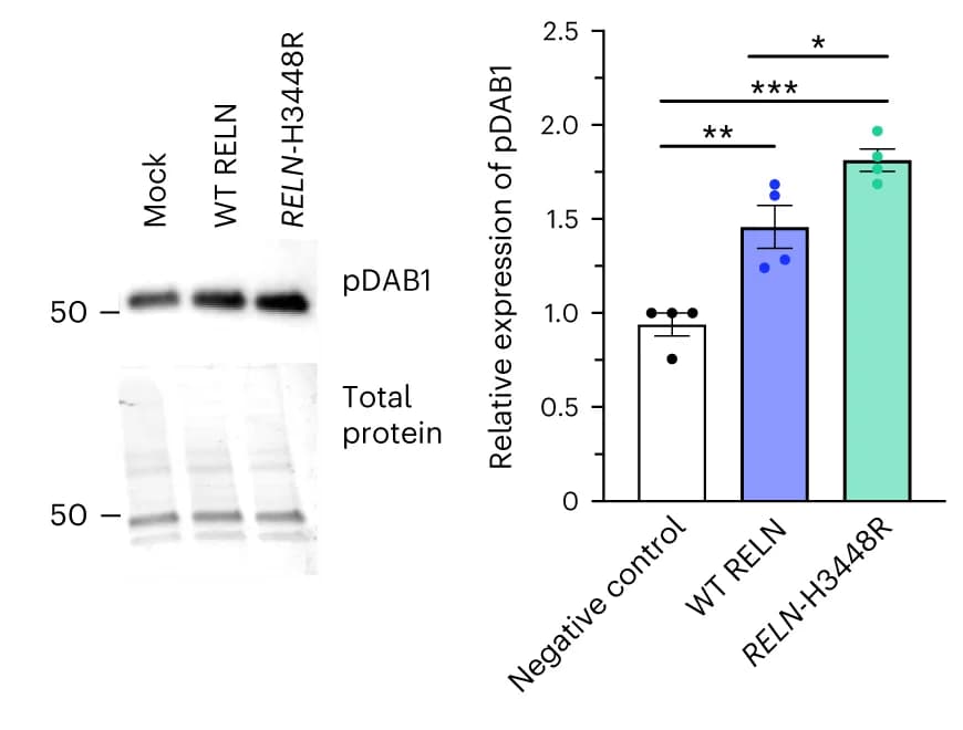 Open access visualization of Bar Plot, Error Bars, Western Blotting, pDab1 Levels, Protein Staining