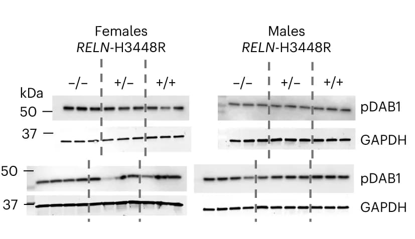 Open access visualization of Gel, Western Blots, pDab1, GAPDH, Cerebellum