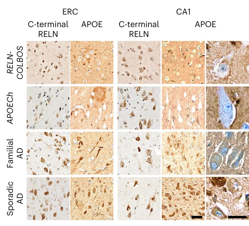 Open access visualization of Microscopy, C-terminal RELN, APOE, RELN-COLBOS, APOECh
