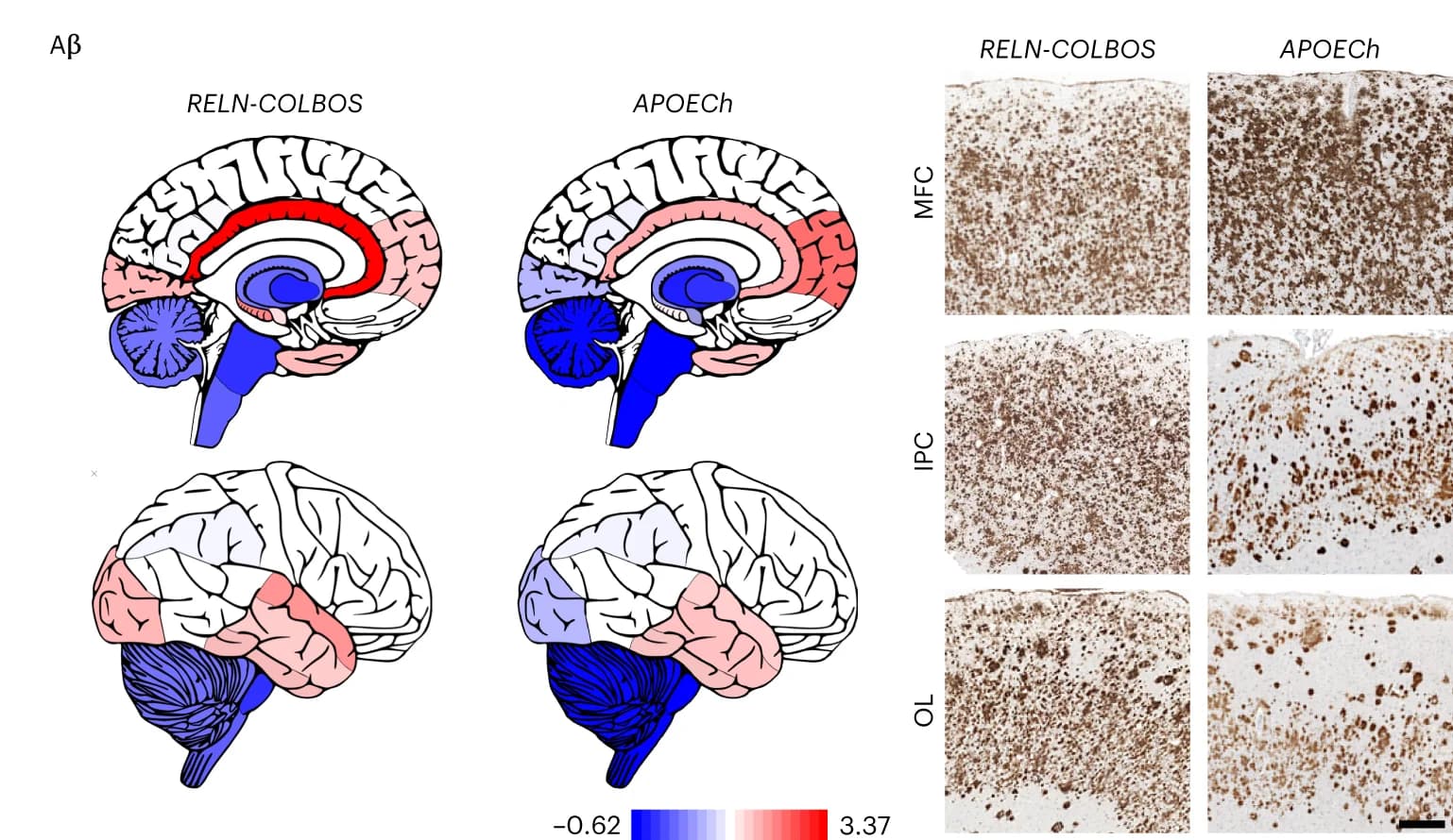 Open access visualization of Illustration, Microscopy, Abeta, Pathology Signals, RELN-COLBOS