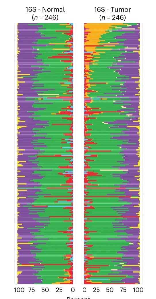 Open access visualization of Stacked Bar Plot, Microbiome Composition, 16S rRNA Gene-Sequencing, Tumor, Healthy Colon Tissue