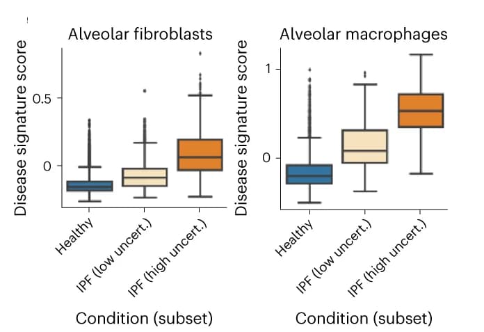 Open access visualization of Box Plot, Disease Signature, Alveolar Fibroblasts, Alveolar Macrophages, Control Donors