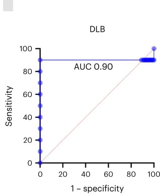 Open access visualization of Scatter Plot, ROC curves, Serum, Control group, DLB