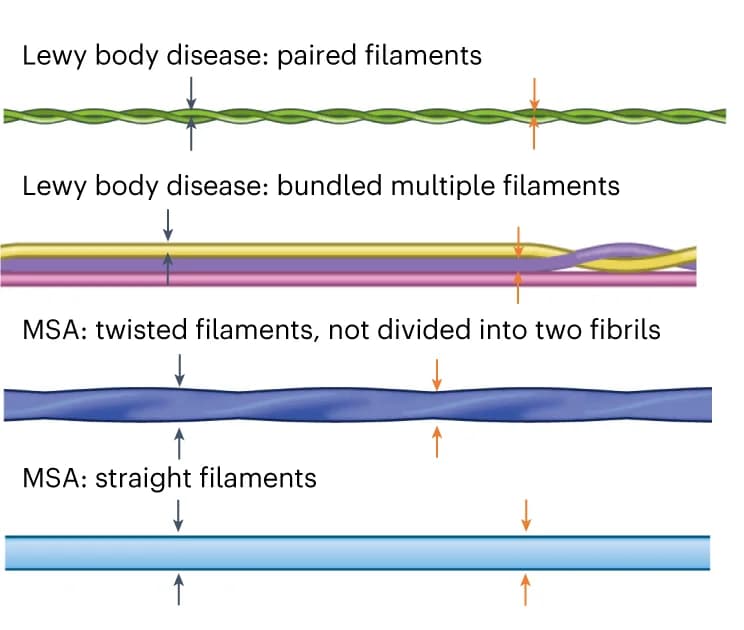 Open access visualization of Illustration, Serum, IP/RT-QuIC, LB Diseases, MSA