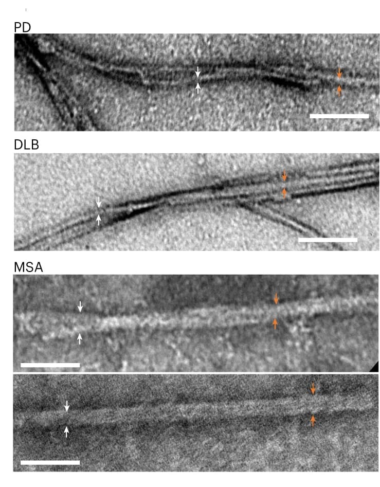 Open access visualization of Microscopy, TEM Images, Serum, IP/RT-QuIC, Parkinson's Disease