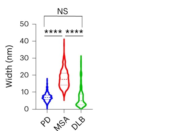 Open access visualization of Violin Plot, Violin Plots, Distribution, Statistical Analysis, ANOVA