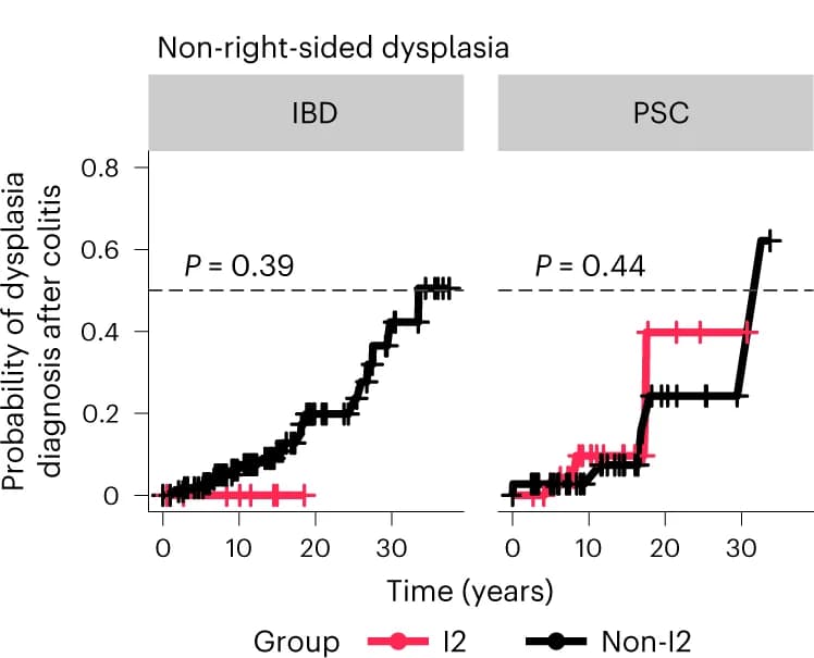 Open access visualization of Line Plot, Line Step, Survival Curve, Kaplan-Meier Curves, Non-Right-Sided Dysplasia