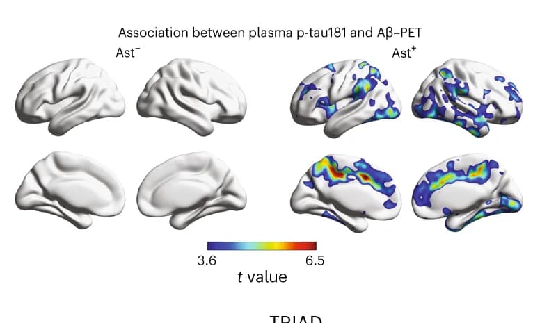 Open access visualization of Heatmap, Voxel-wise Regression, Multiple Comparisons, Aβ-PET, Plasma p-tau181