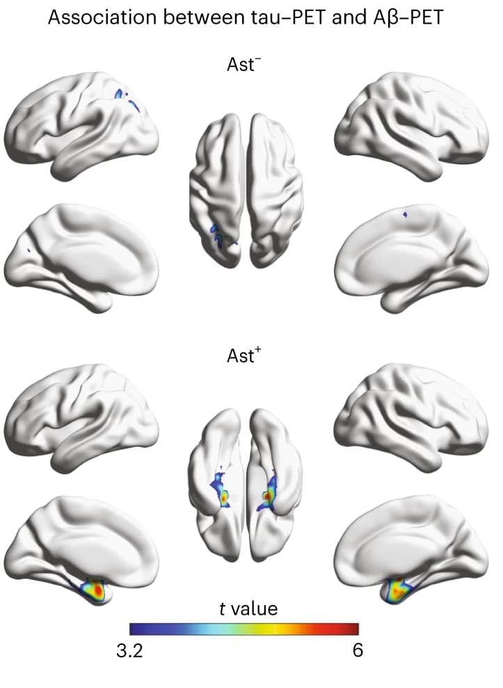 Open access visualization of 3D Plot, Protein Structure, Astrocyte Reactivity, Aβ-PET, Tau-PET