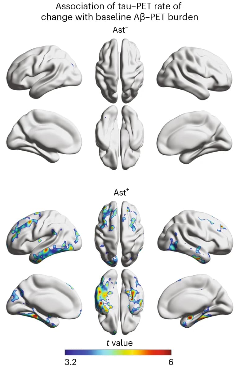 Open access visualization of 3D Plot, Protein Structure, Tau-PET, Amyloid-PET, Astrocyte reactivity