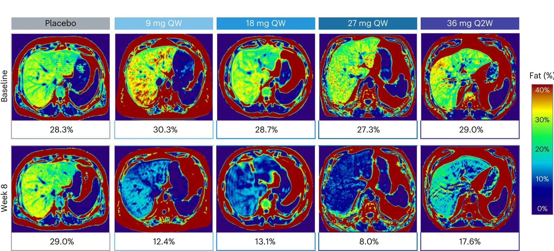 Open access visualization of Microscopy, MRI-PDFF, Liver Fat Fraction, Baseline, Participants