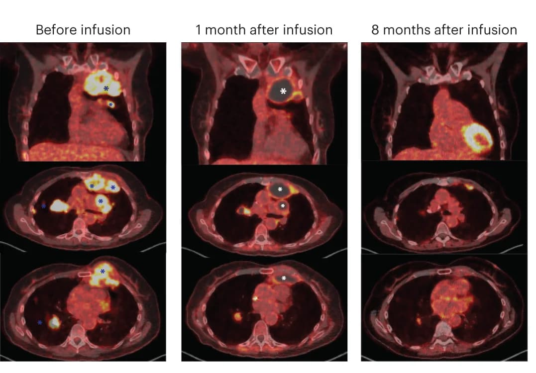 Open access visualization of Microscopy, PET-CT Images, Tumor Areas, Fluid-filled Regions, Tumor Regression