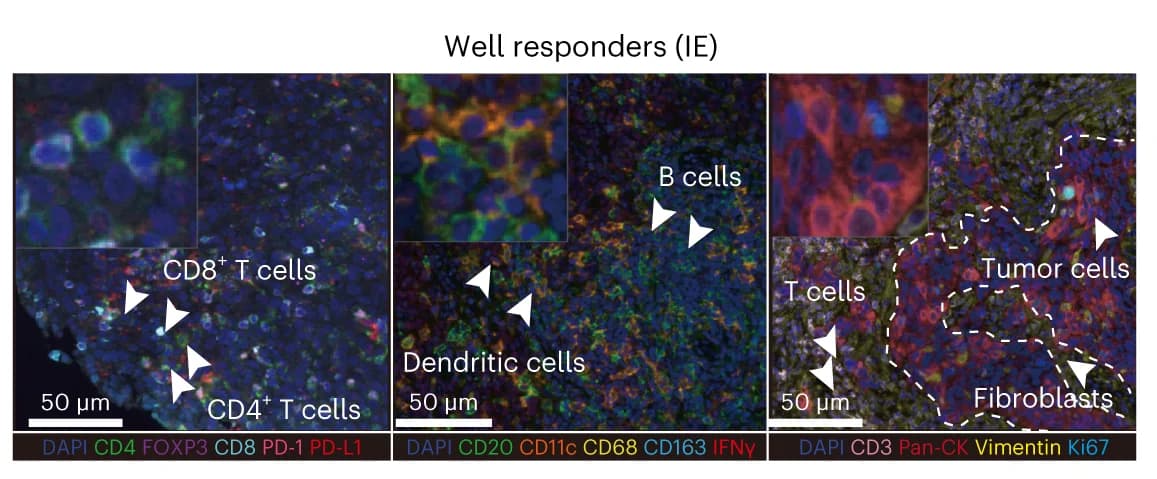 Open access visualization of Microscopy, Multiplex Immunofluorescence, Responders, Images