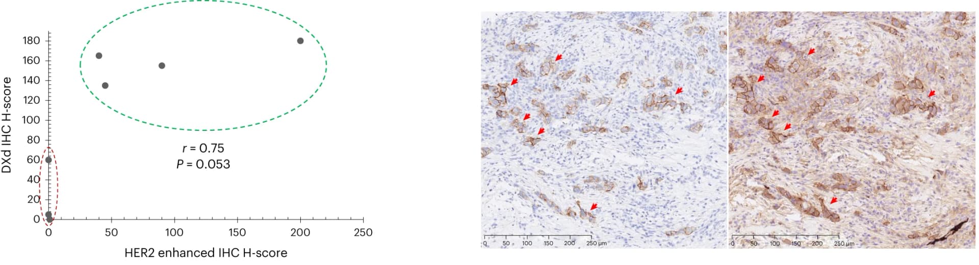 Open access visualization of Scatter Plot, Microscopy, T-DXd, HER2, IHC