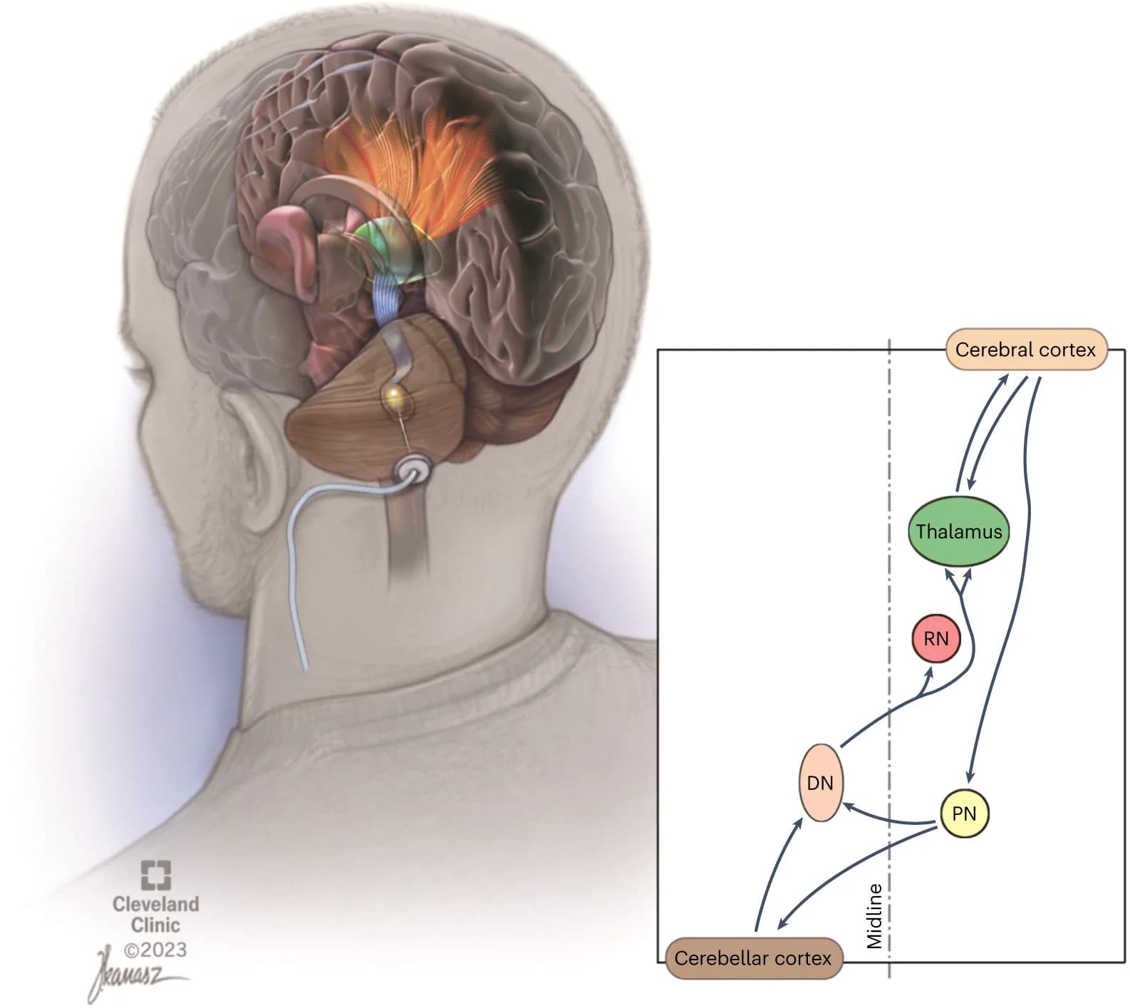 Open access visualization of Illustration, Workflow, Flowchart, Dentatothalamic Projections, Thalamic Nuclei