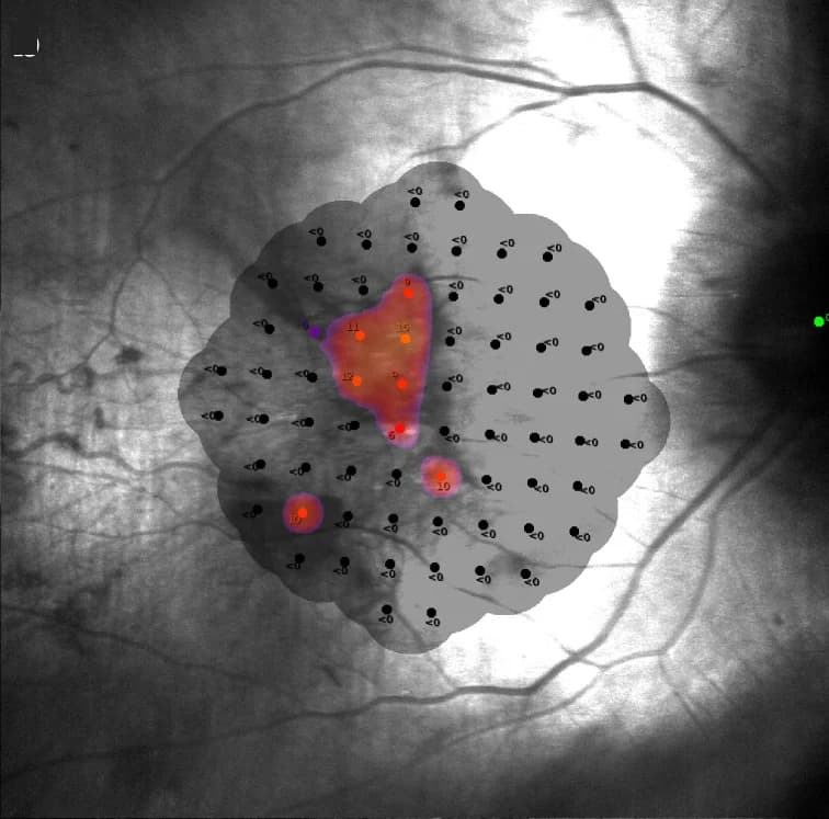 Open access visualization of Microscopy, Microperimetry, Visual Field
