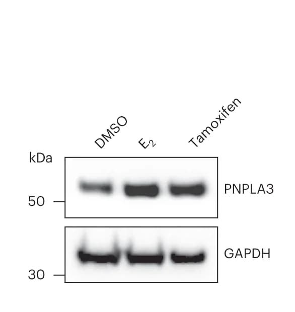 Open access visualization of Gel, Western Blot, PNPLA3 Protein, HepG2 Cells, E2