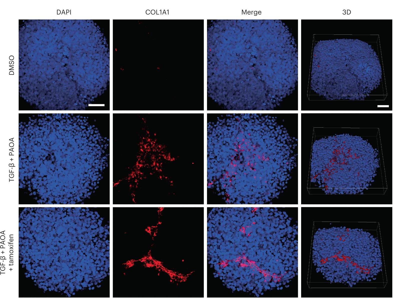 Open access visualization of Microscopy, Immunofluorescence, DAPI, COL1A1, 3D Spheroids
