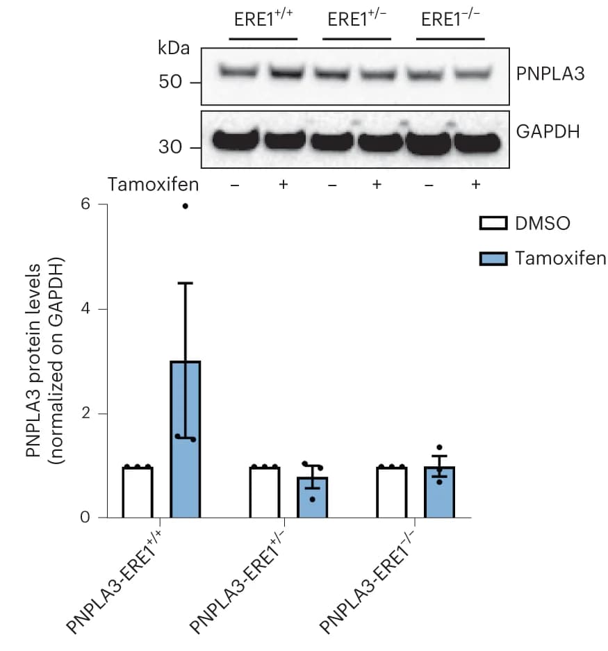 Open access visualization of Bar Plot, Error Bars, Gel, Western Blot, PNPLA3 Protein