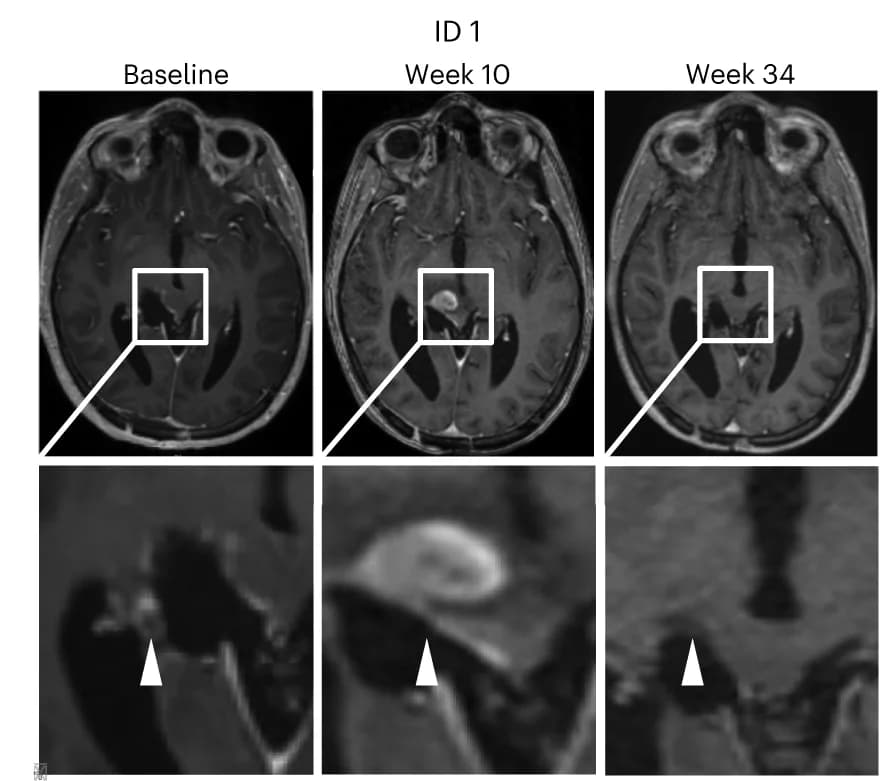 Open access visualization of Microscopy, MRI, PsPD, Tumor Lesion