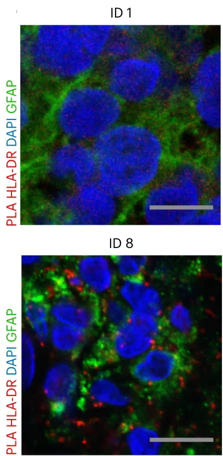 Open access visualization of Microscopy, PLA, Tumor Tissue, H3K27M, HLA-DR antibodies