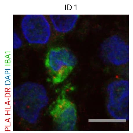 Open access visualization of Microscopy, PLA, Tumor Tissue, H3K27M, HLA-DR antibodies