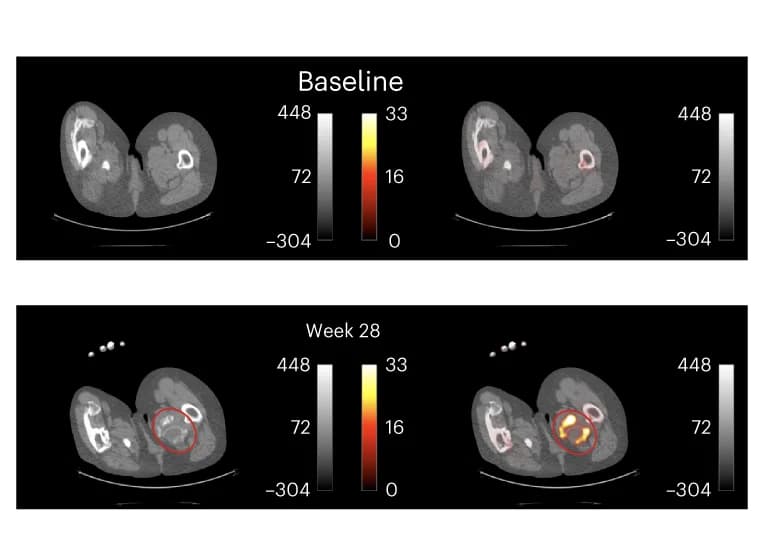 Open access visualization of Microscopy, Transaxial CT, PET-CT, Baseline, HO Lesion