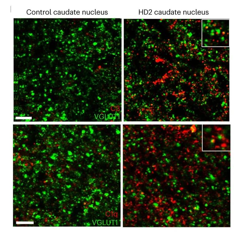 Open access visualization of Microscopy, Confocal Images, VGLUT1, Complement C3, Complement C1q