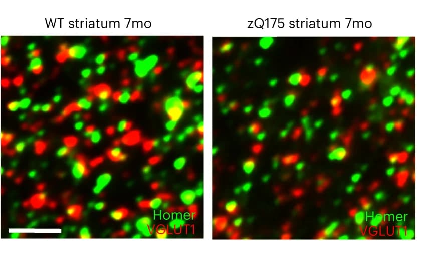 Open access visualization of Microscopy, Array Tomography, Dorsolateral Striatum, zQ175 Mice, WT Littermates
