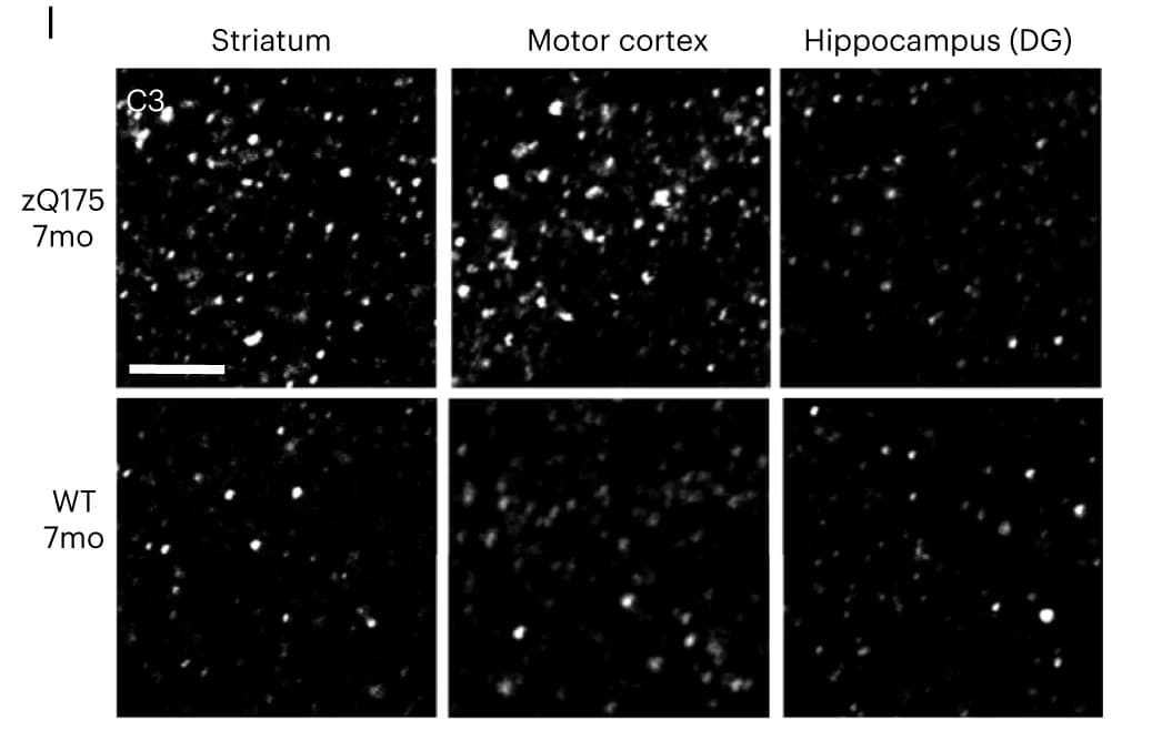 Open access visualization of Microscopy, Confocal Images, C3 Staining, Dorsolateral Striatum, Motor Cortex