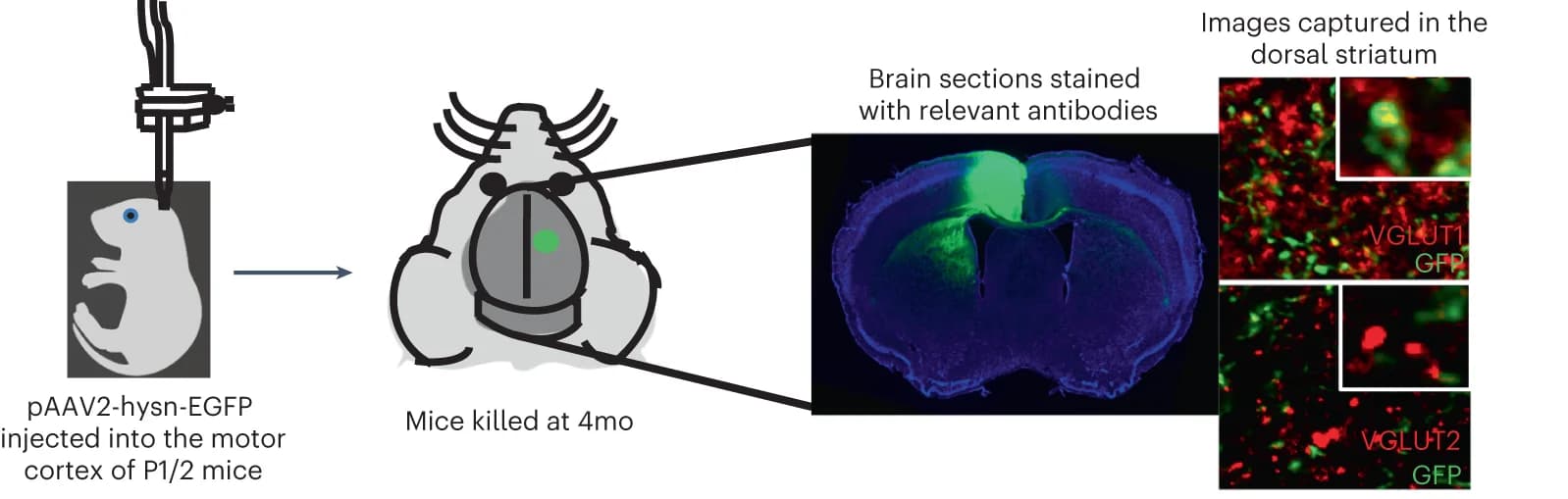 Open access visualization of Microscopy, Illustration, Corticostriatal projections, Motor cortex, Dorsal striatum