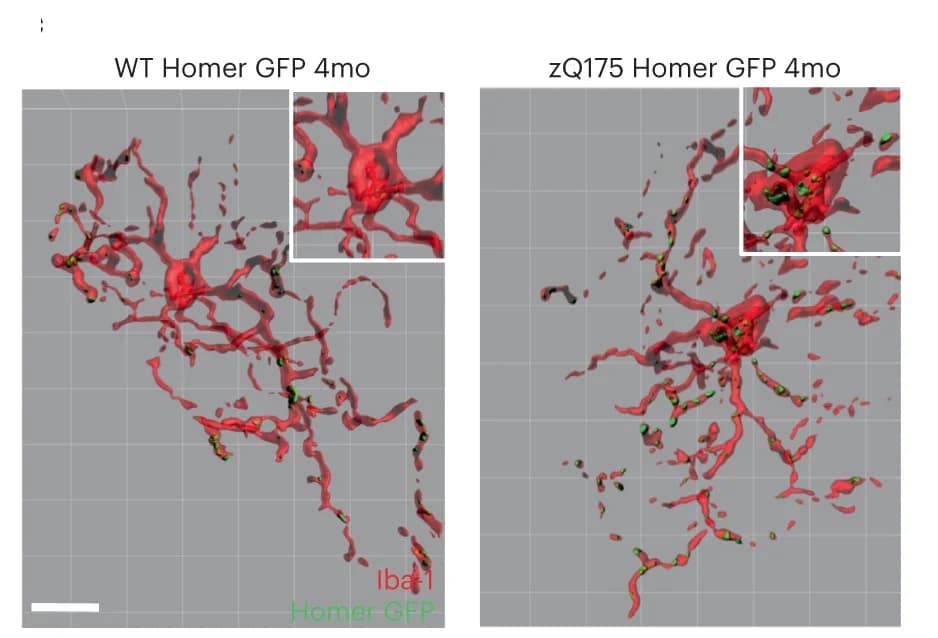 Open access visualization of Microscopy, Microglia, Homer-GFP, Dorsal striatum, zQ175 Homer-GFP Mice