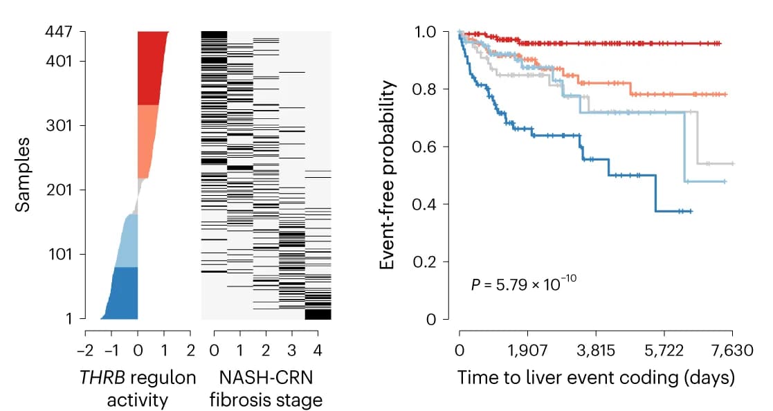 Open access visualization of Survival Curve, Heatmap, THRB Regulon, Differential Activity Plot, Disease Stage