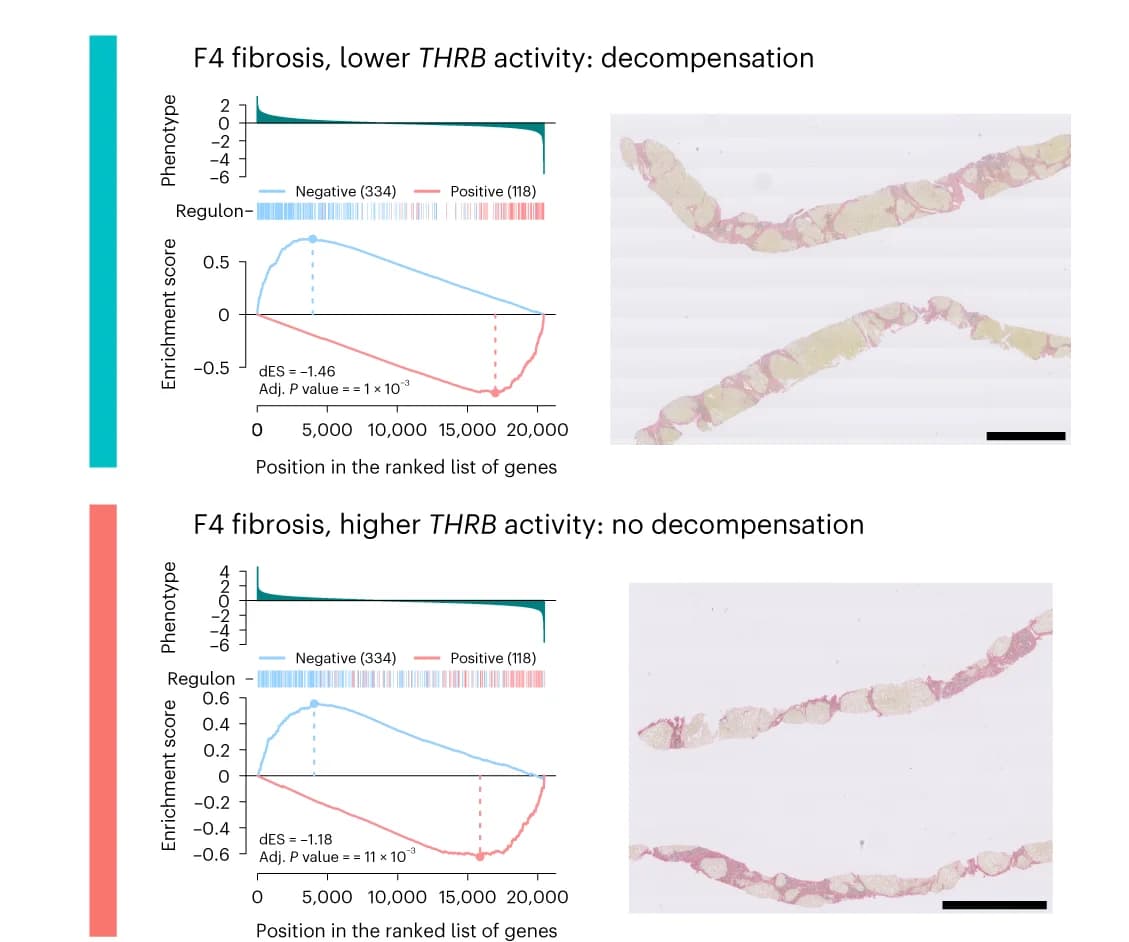 Open access visualization of Line Plot, Microscopy, Gene Set Enrichment Plots, Target Genes, THRB Regulon