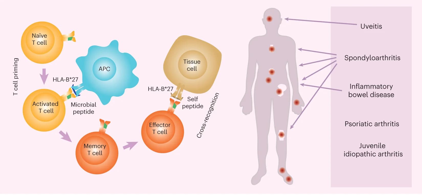 Open access visualization of Workflow, Illustration, Arthritogenic Peptide, CD8+ T Cells, HLA-B*27