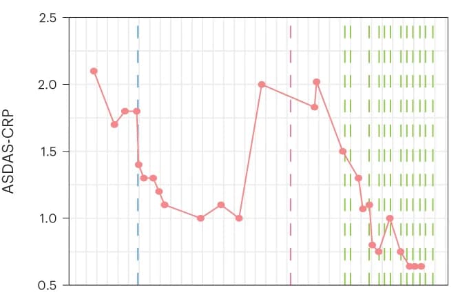 Open access visualization of Line Plot, Ankylosing Spondylitis, Disease Activity Score, C-Reactive Protein, ASDAS-CRP