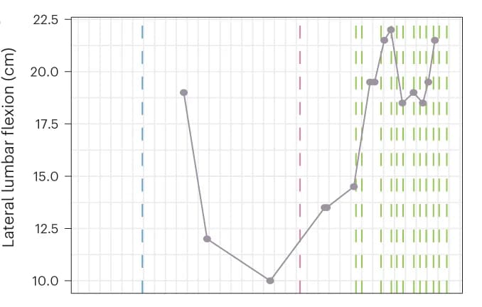 Open access visualization of Line Plot, Bar Plot, Spinal Mobility, Treatment History